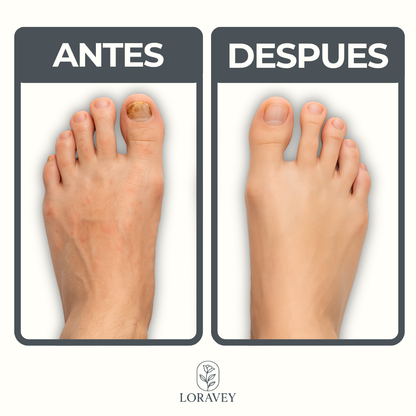 LORAVEY | ACEITE ANTIFUNGICO